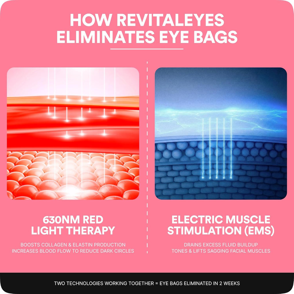 BOTANIQUE PARIS® RevitalEyes Under Eye Red Light Therapy [WITH ANTI EYE BAG CREAM] - Light Therapy Device Bundle for Under Eye Bags, Puffiness & Fine Lines - Skincare Tool for all Skin Types