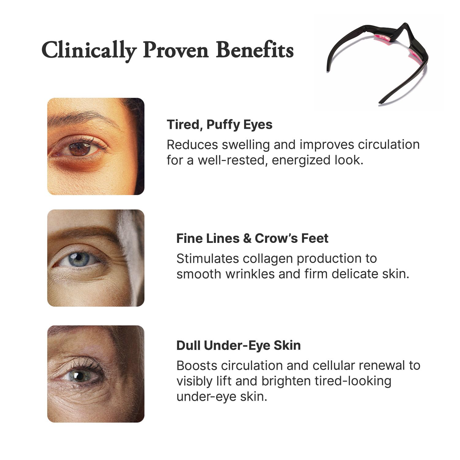 Capillus Eyelift Red Light Therapy for Eyes - Under Eye Red Light Therapy Glasses 685nm - Red Light Therapy for Eyes Bags, Wrinkles, Fine Lines, Crow's Feet and Dark Circles