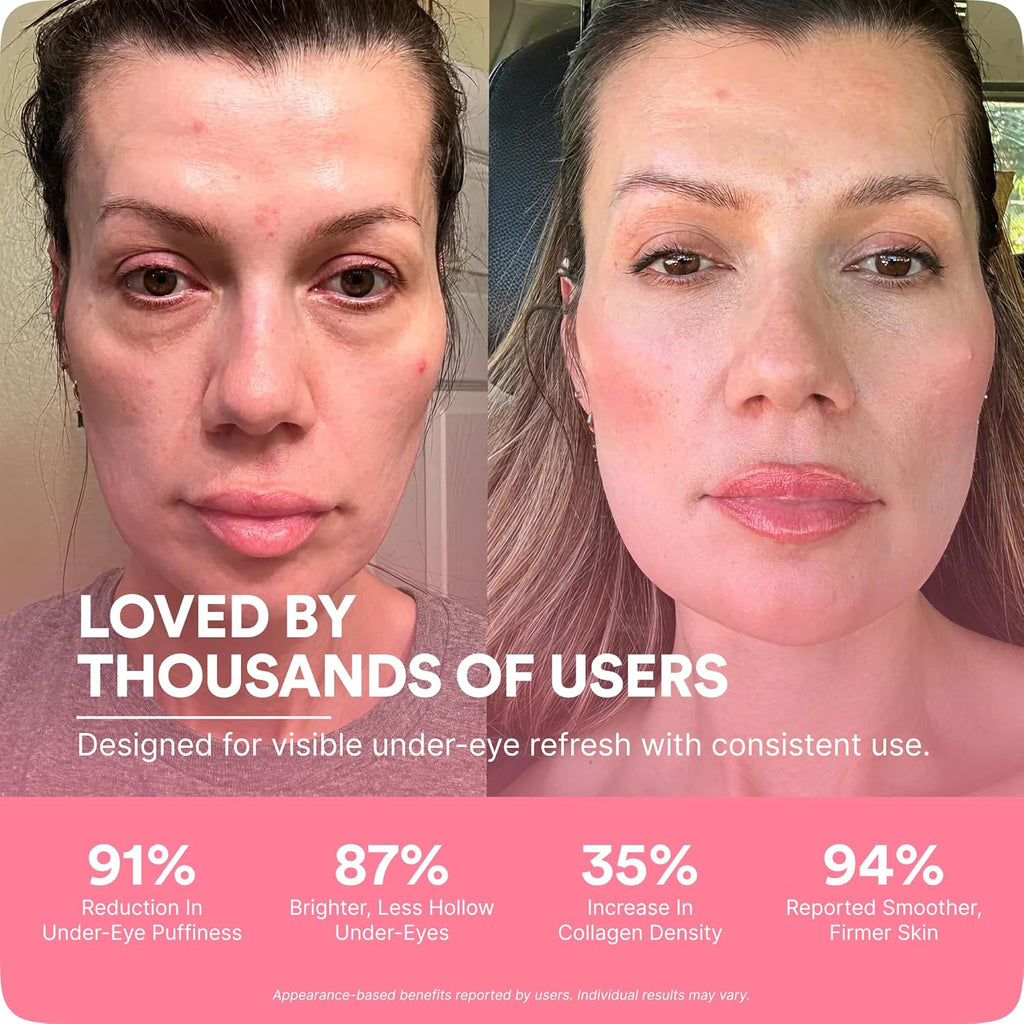 BOTANIQUE PARIS® RevitalEyes Under Eye Red Light Therapy [WITH ANTI EYE BAG CREAM] - Light Therapy Device Bundle for Under Eye Bags, Puffiness & Fine Lines - Skincare Tool for all Skin Types